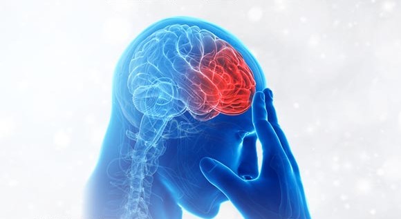뇌졸중 전조 증상과 자가 진단법은?